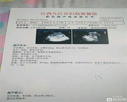 51宝贝助孕哪里技术好：怀孕初期的10个症状