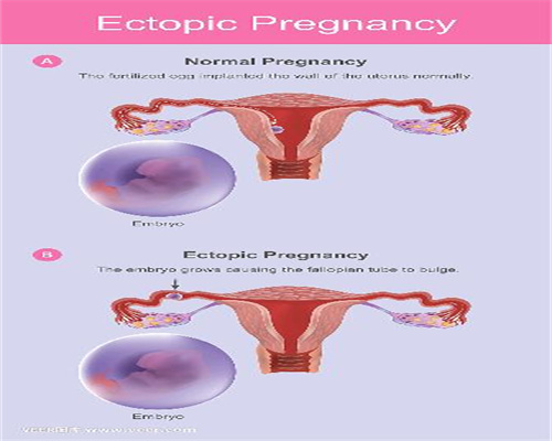 添丁助孕~增强卵巢功能的方法是什么