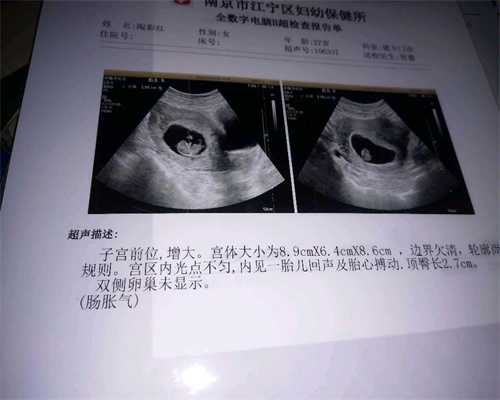 代孕公司哪里好-中国代孕技术-孕妇什么时候开始
